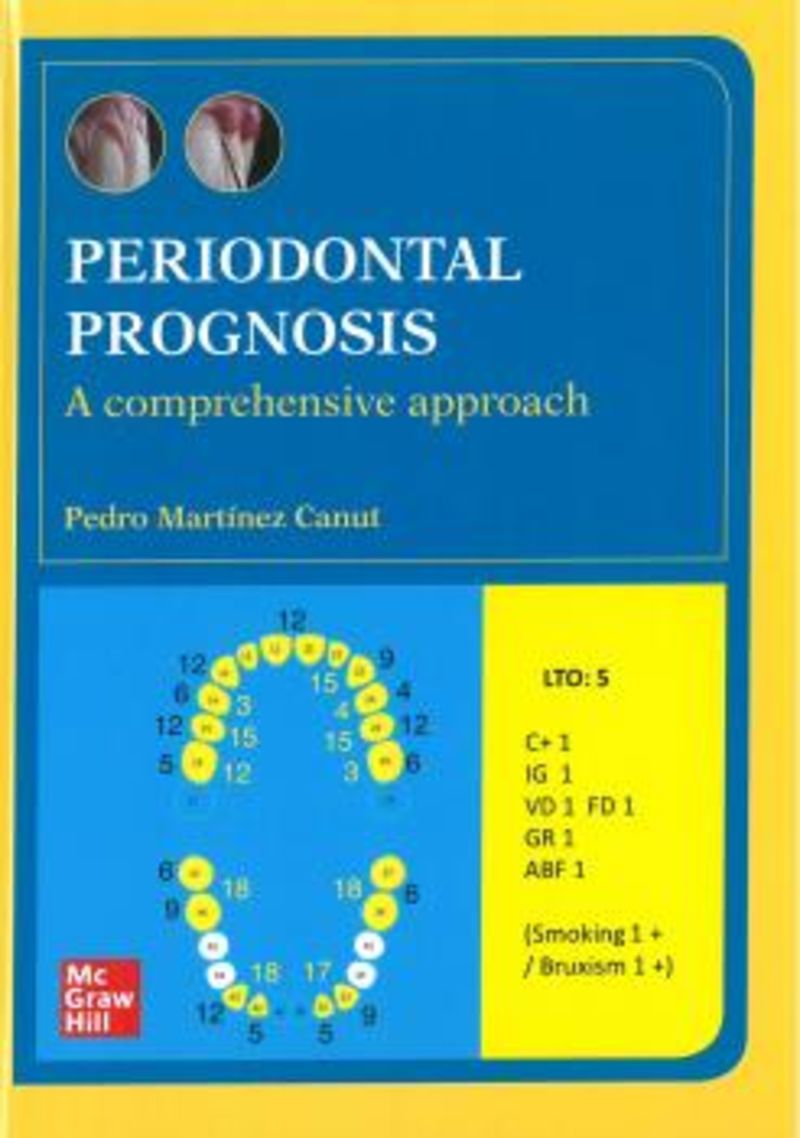 periodontal prognosis - Pedro Martinez Canut