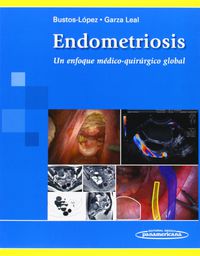 endometriosis - un enfoque medico-quirurgico global