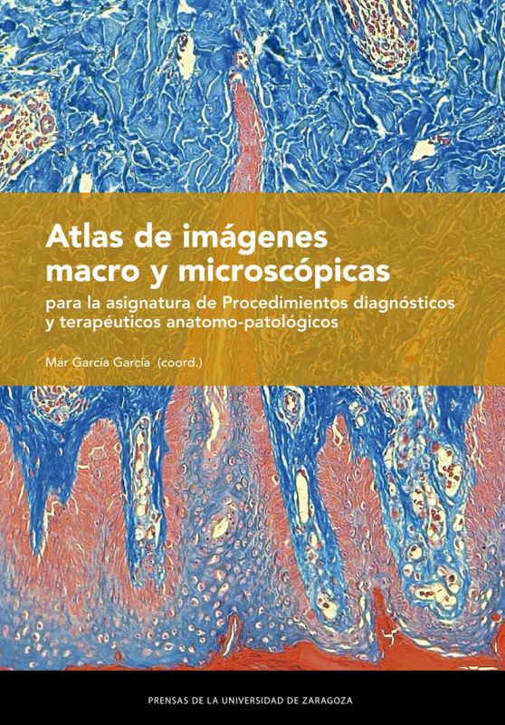 ATLAS DE IMAGENES MACRO Y MICROSCOPICAS - PARA LA ASIGNATURA DE PROCEDIMIENTOS DIAGNOSTICOS Y TERAPEUTICOS ANATOMO-PATALOGICOS