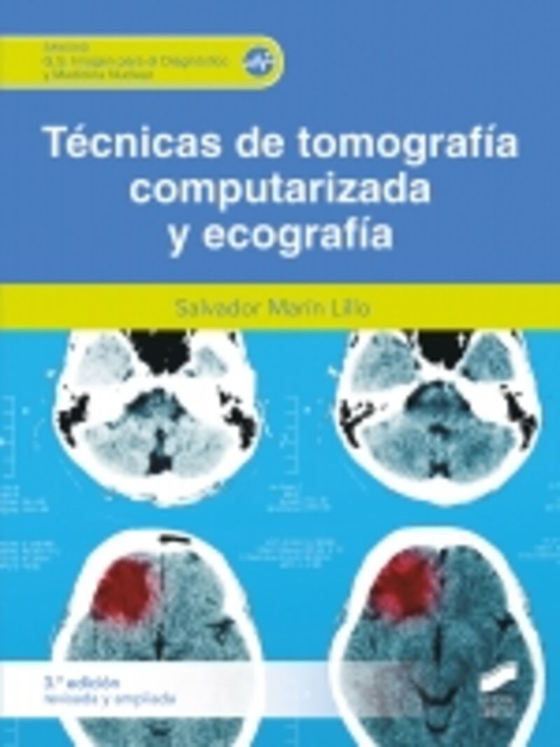 (3 ED) GS - TECNICA DE TOMOGRAFIA COMPUTARIZADA Y ECOGRAFIA 3A EDICION REVISADA