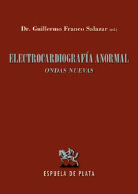 electrocardiografia anormal - (ondas nuevas)