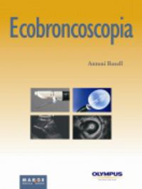 ecobroncoscopia - Antoni Rossell Gratacos