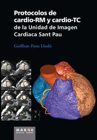 protocolos de cardio-rm y cardio-tc de la unidad de imagen cardiaca sant pau - Guillermo Pons Llado