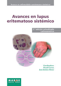 avances en lupus eritematoso sistemico - latinoamerica - Ricard Cervera Segura / Juan Jimenez Alonso