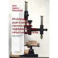gs - protesis parciales removibles metalicas de resina y mixta - Ramon A. Barrocal Martinez