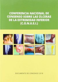 (2 ed) conferencia nacional de consenso sobre ulceras de la extremidad inferior (c-o. n. u. e. i. ) - Josep Marinello / [ET AL. ]