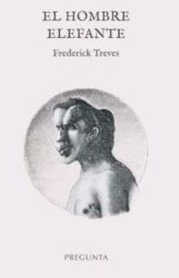 El hombre elefante - Frederick Treves
