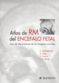 atlas de rm del encefalo fetal - Adamsbaum