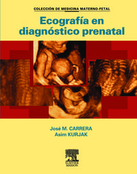 ecografia en diagnostico prenatal - Jose Carrera / Asim Kurjak