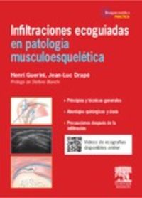 infiltraciones ecoagudas en patologia musculoesqueletica - Henri Guerini / Jean-Luc Drape