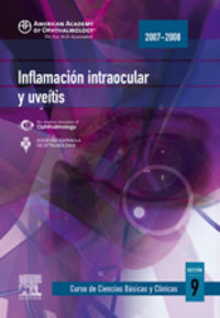 inflamacion intraocular y uveitis