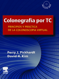 COLONOGRAFIA POR TC (+DVD)