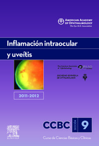 inflamacion intraocular y uveitis 2011-2012