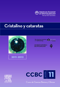 cristalino y cataratas 2011-2012