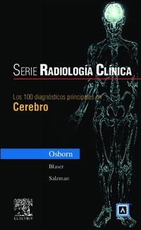 SERIE RADIOLOGIA CLINICA - 100 DIAGNOSTICOS PRINCIPALES EN CEREBRO