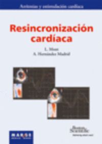 resincronizacion cardiaca - Antonio Hernandez Madrid