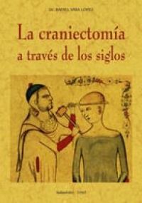 La craniectomia a traves de los siglos - Rafael Vara Lopez
