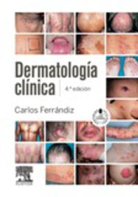 (4ª ed) dermatologia clinica (+student consult) - Carlos Ferrandiz Foraster