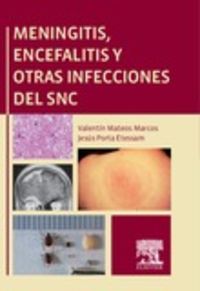 meningitis, encefalitis y otras infecciones del snc - Valentin Mateos Marcos / Jesus, Porta Etessam