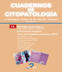 CITOLOGIA GINECOLOGICA - INFECCIONES FUNGICAS - VIRUS DEL PAPILOMA HUMANO (HPV)