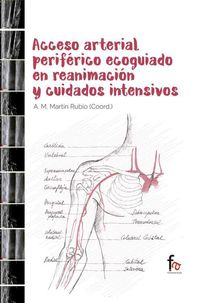 acceso arterial periferico ecoguiado en reanimacion y cuidados intensivos - Antonio M. Martin Rubio