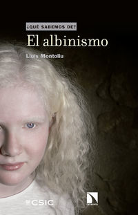 El albinismo - Lluis Montoliu