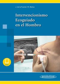 INTERVENCIONISMO ECOGUIADO EN EL HOMBRO (+EBOOK)