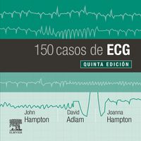 (5 ed) 150 casos de ecg