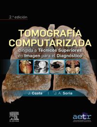 (2 ed) tomografia computarizada dirigida a tecnicos superiores en imagen para el diagnostico