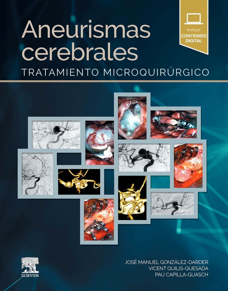 aneurismas cerebrales - Jose Manuel Gonzalez Darder / Vicent Quilis Quesada / Pau Capilla Guasch
