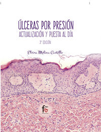 (3 ed) ulceras por presion - Elvira Molina Castillo