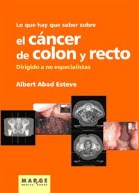 LO QUE HAY QUE SABER SOBRE EL CANCER DE COLON Y RECTO. DIRIGIDO A NO ESPECIALISTAS