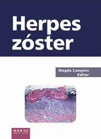 herpes zoster - Magda Campins