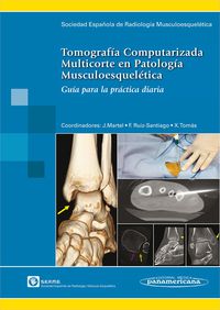 tornografia computarizada multicorte en patologia musculoes - Serme / [ET AL. ]