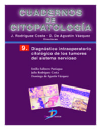 diagnostico intraoperatorio citologico de los tumores del sistema - Emilio Salinero Paniagua / Julio Rodriguez Costa / Domingo De Agustin Vazquez