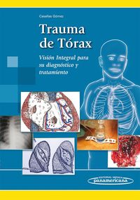 trauma de torax - vision integral para su diagnostico y tra